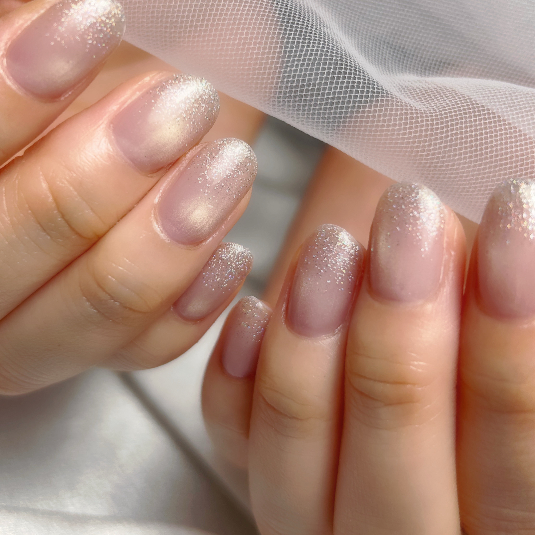 iter_nail_mio
