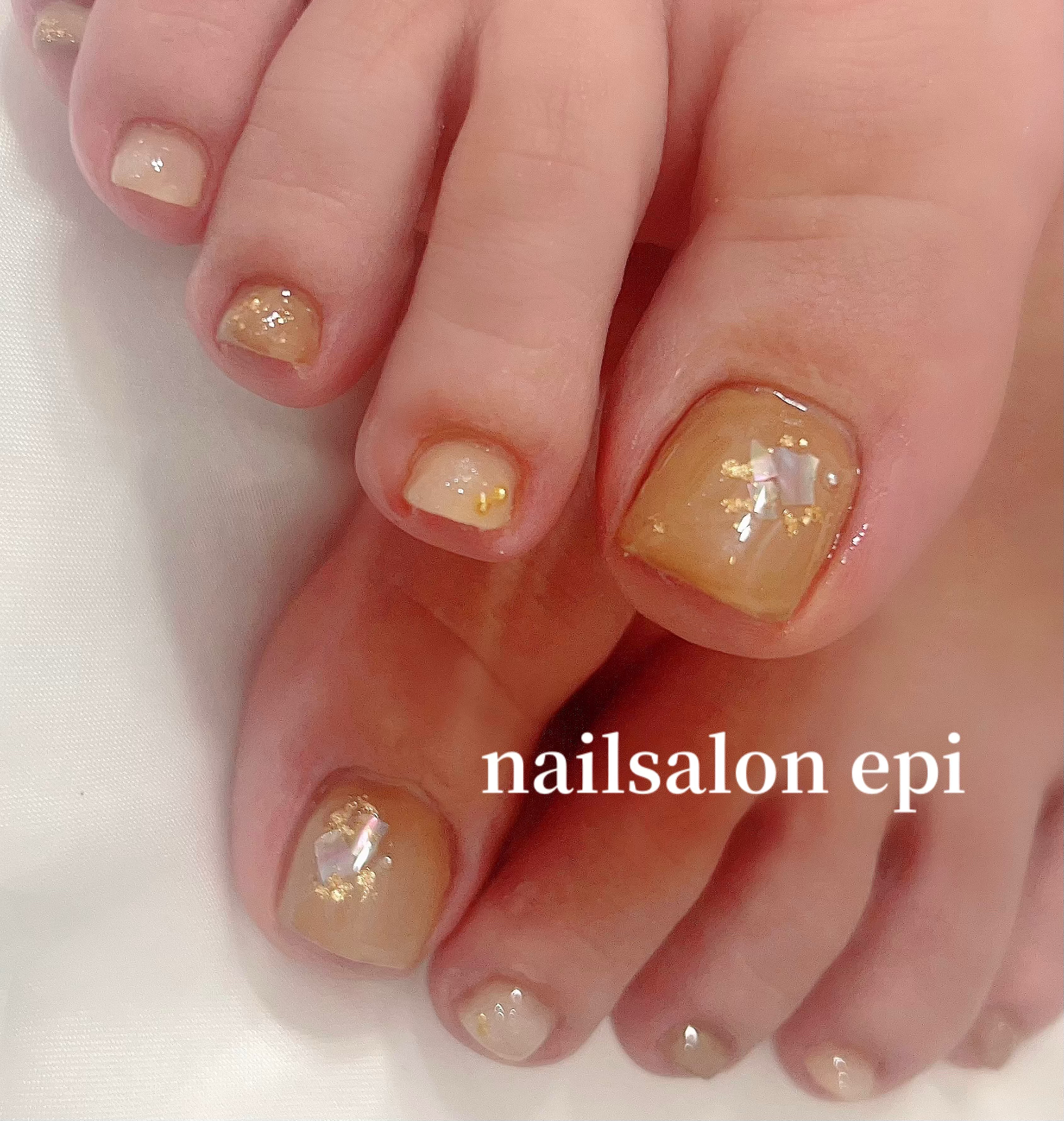 nail.epi