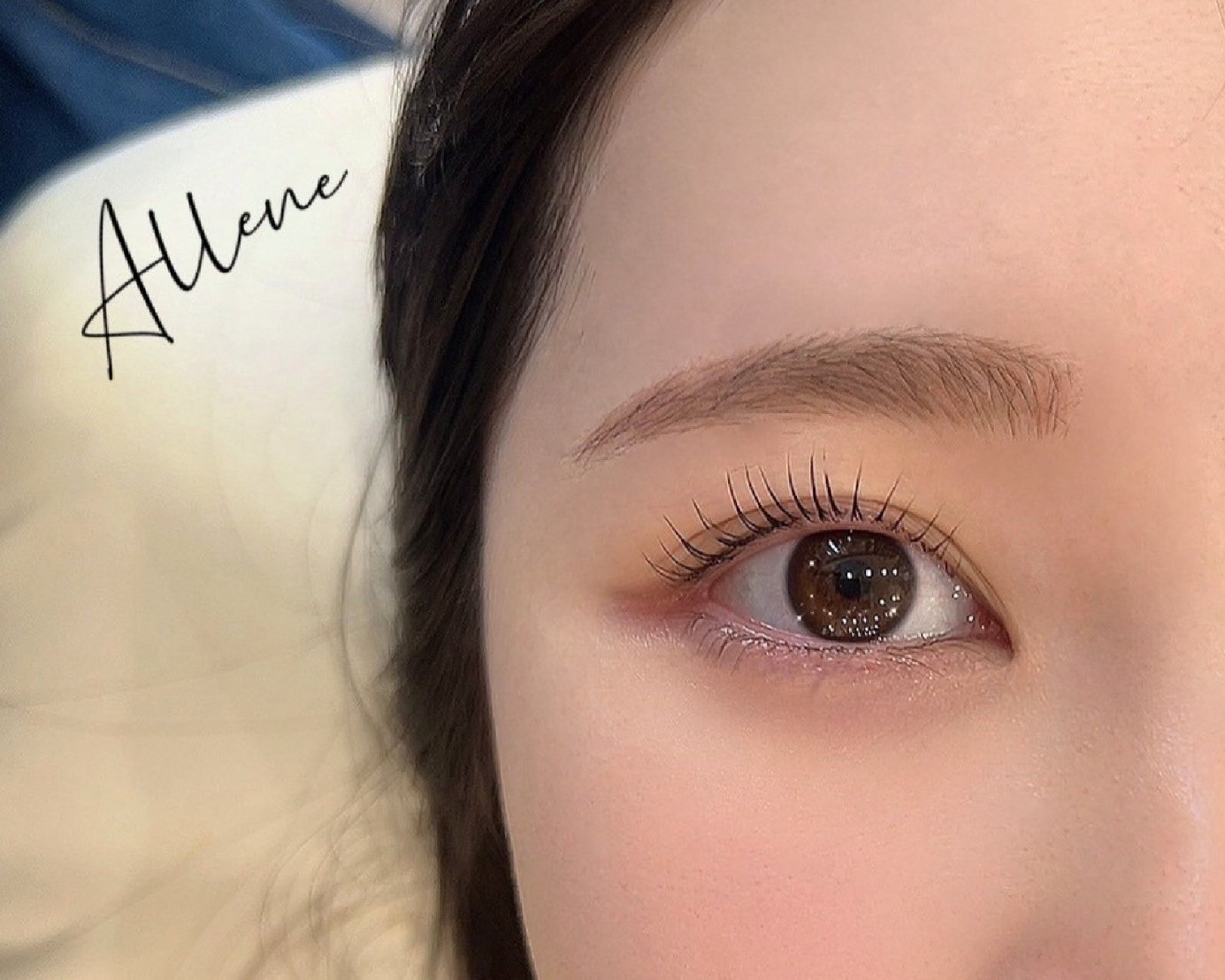 allene