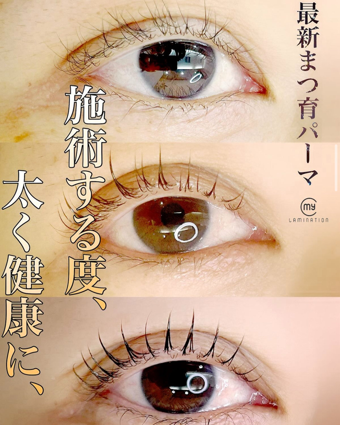 YuMi_EYE