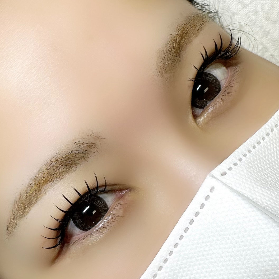 msm_eye