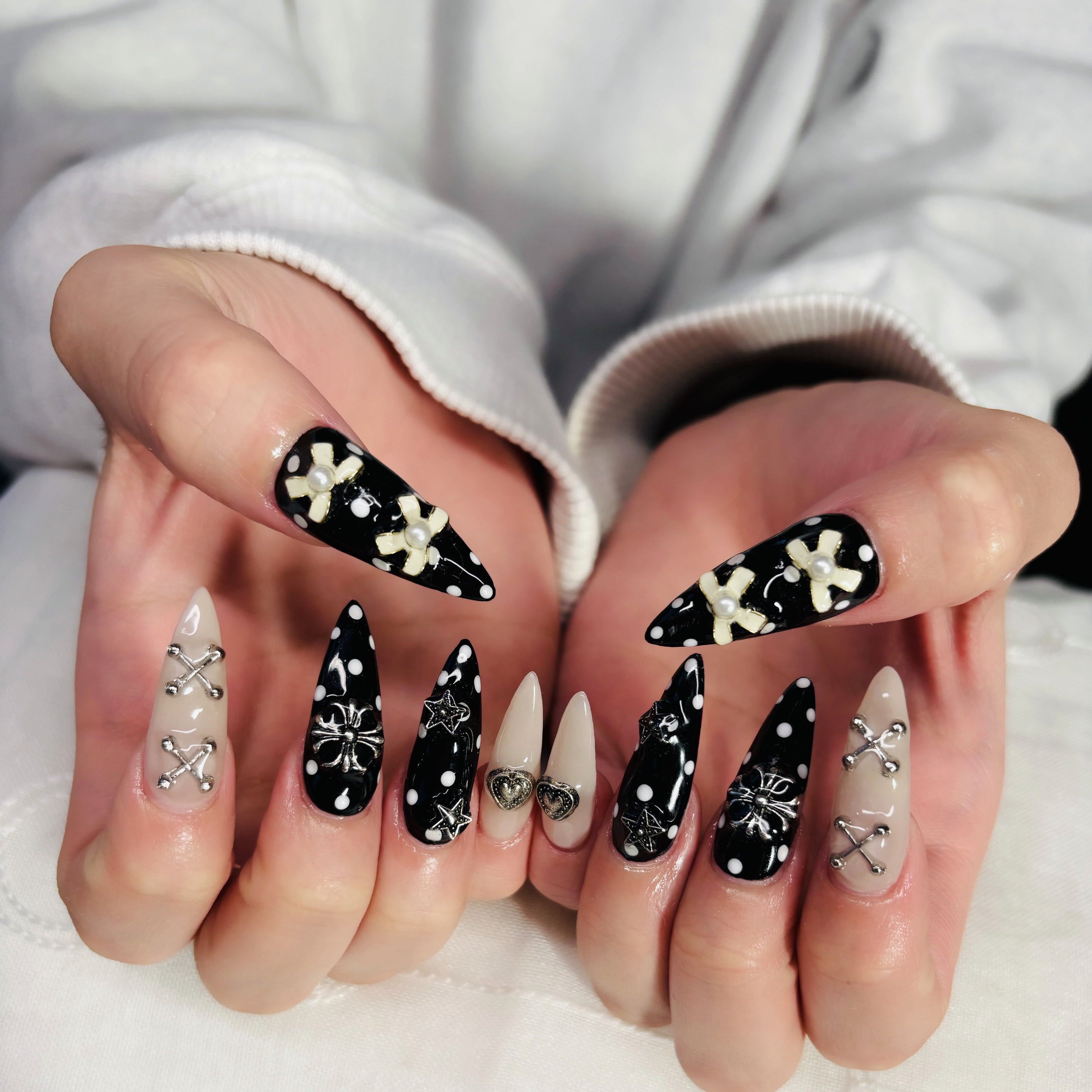 trangnail