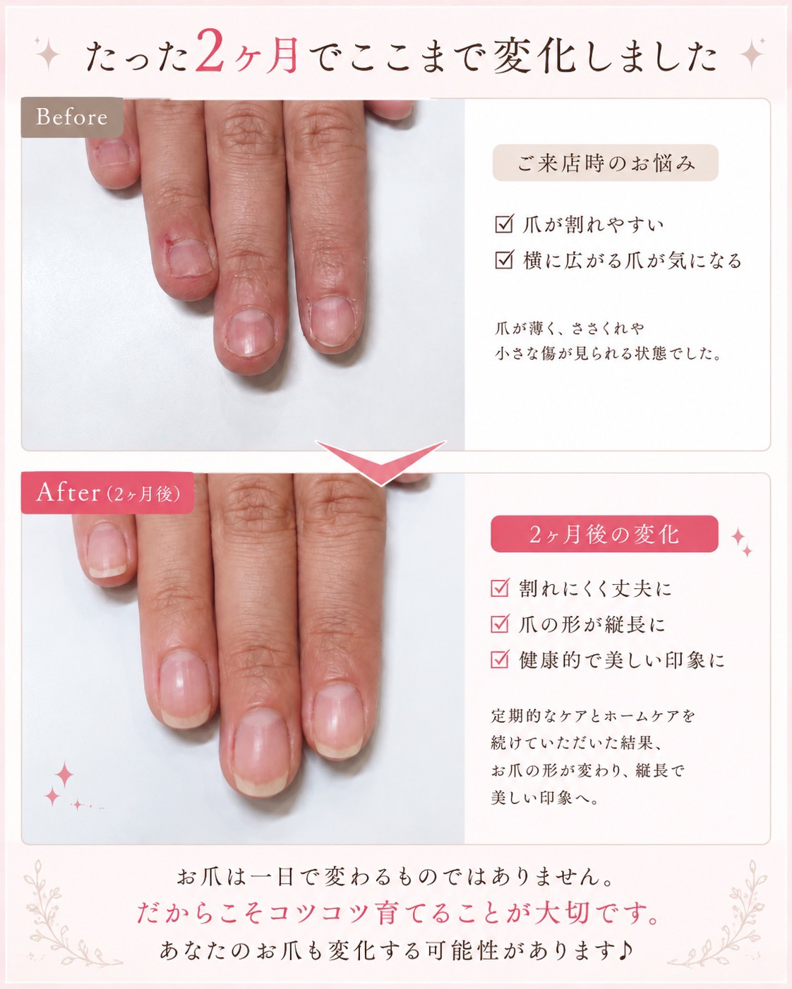 roue.nail