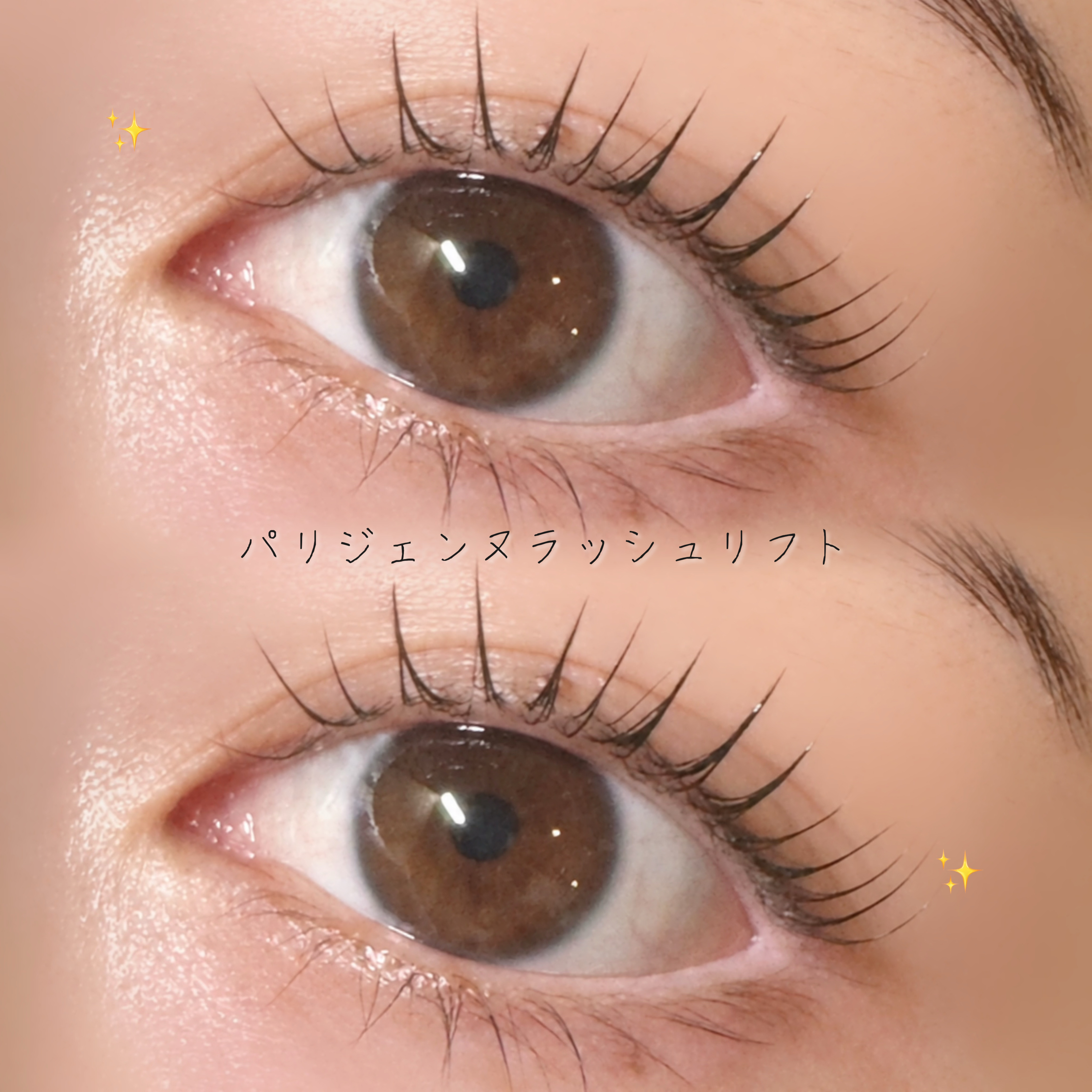 hinata_trueye