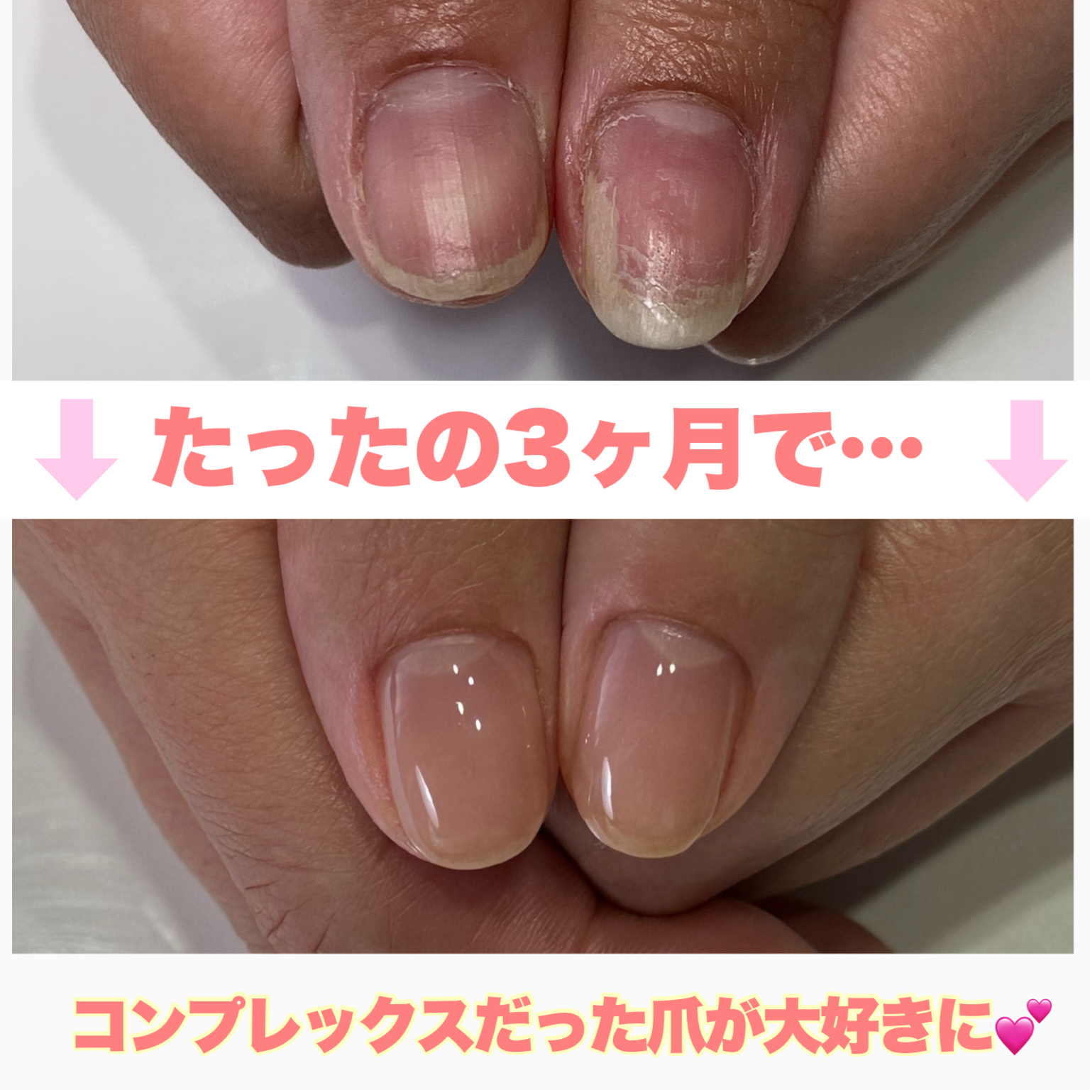 utsunomiya_re.nail