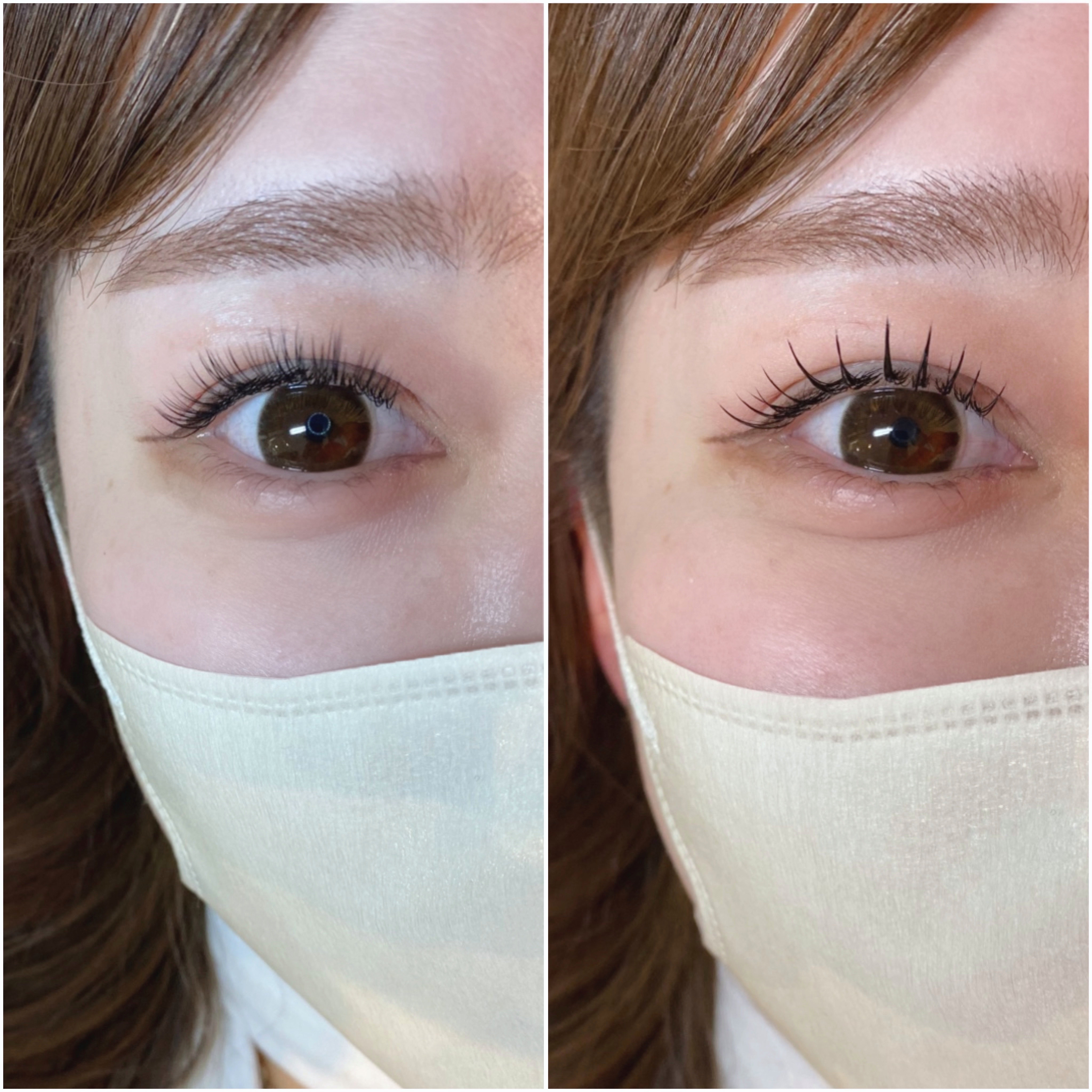 eyelist_aico