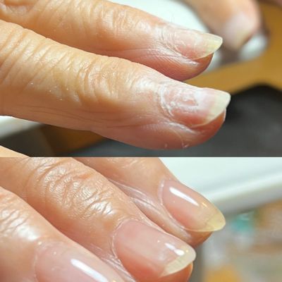 自爪強化