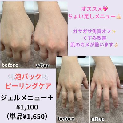 あわあわピーリング【単品】