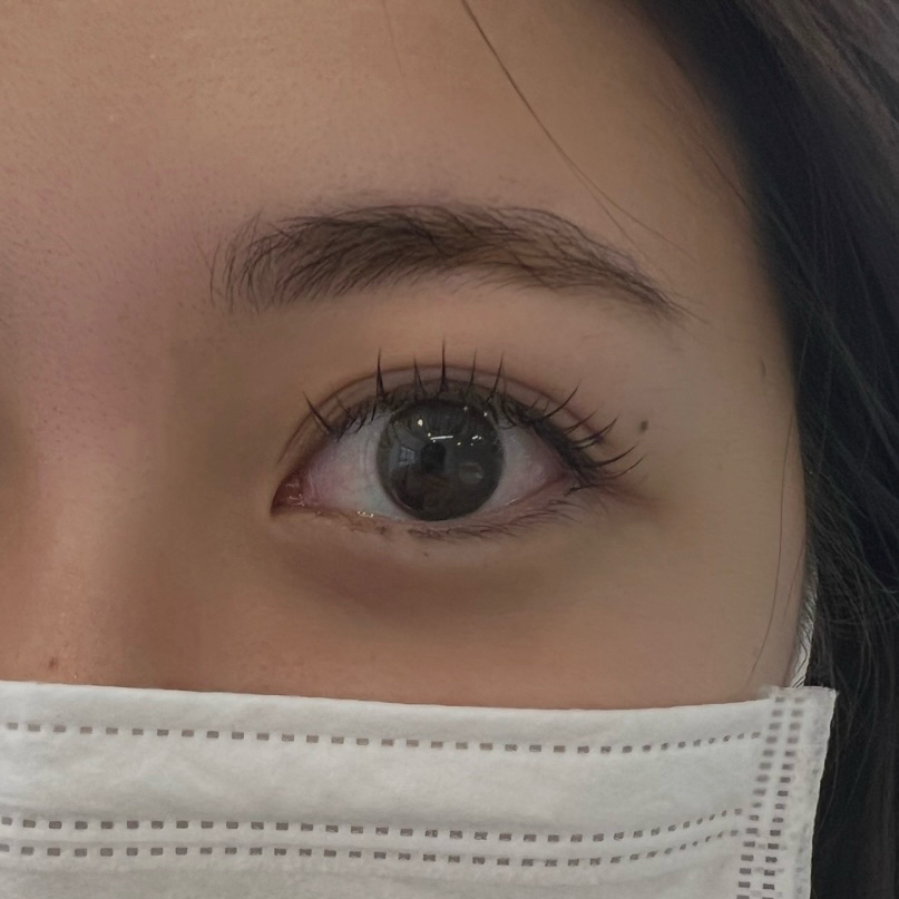 rino_eye