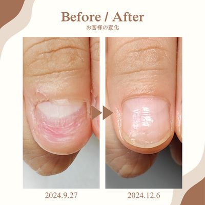 【深爪 / 自爪育成】"隠す"から"魅せる"手元へ。形を整えながら育てるケア🌱