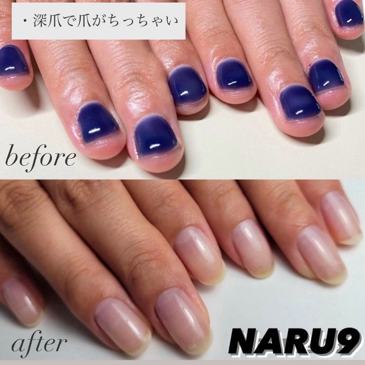 ネイリー（Nailie） - nailsalon_NARU9