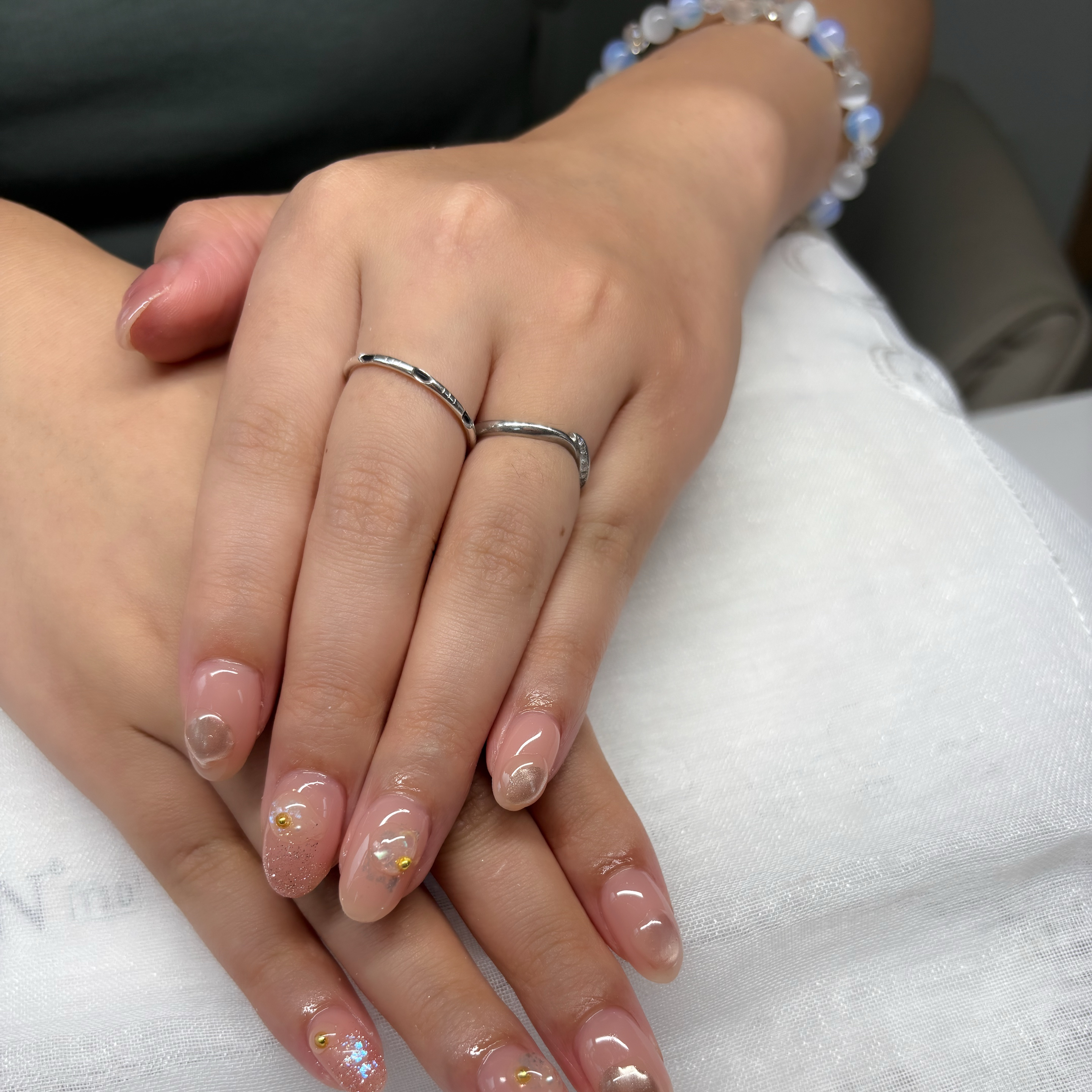 trangnail