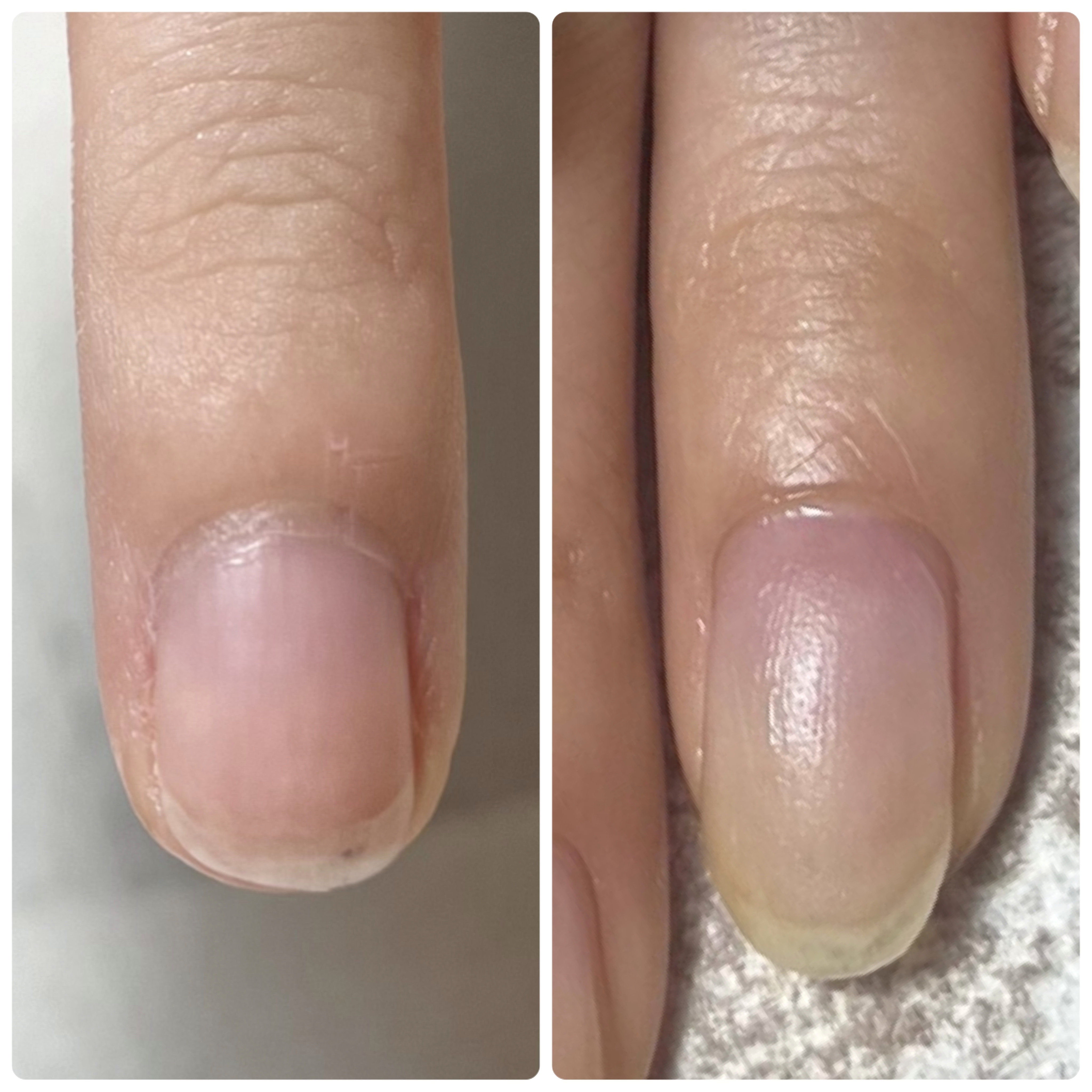 3e5nail