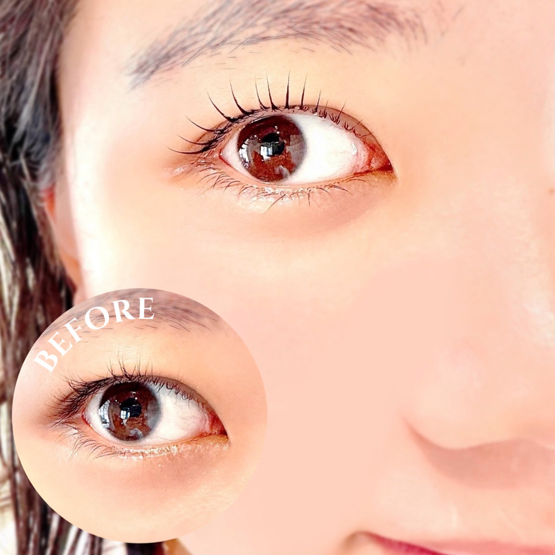 balmy.eye