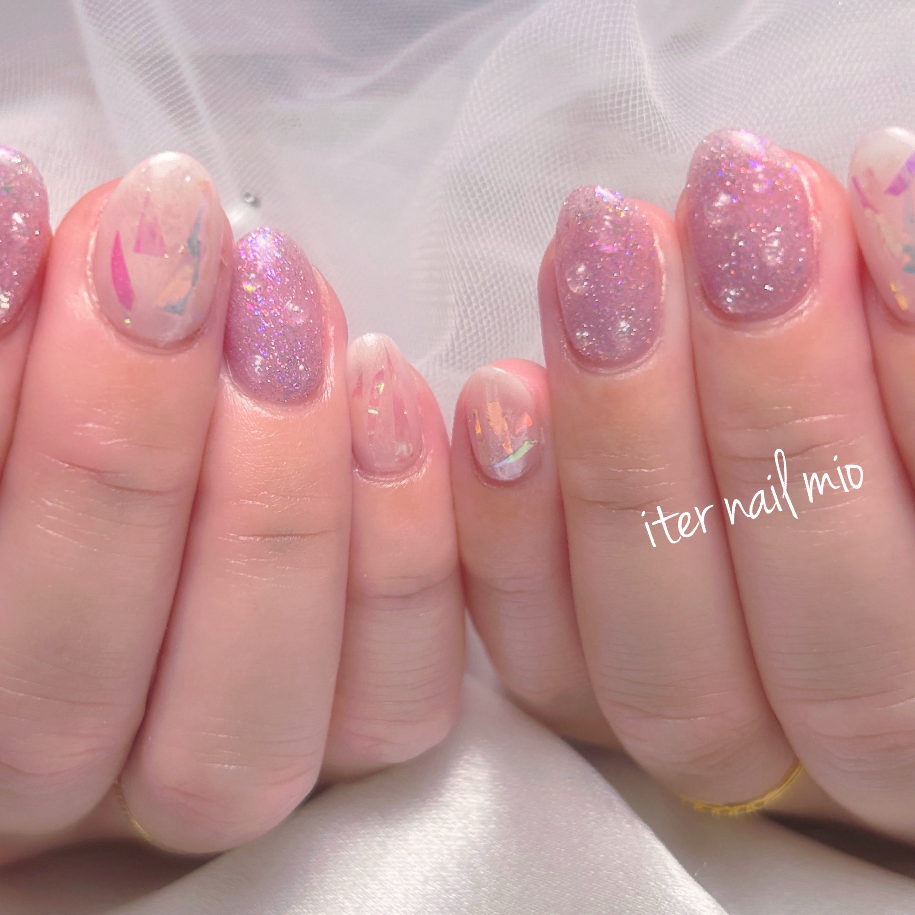 iter_nail_mio