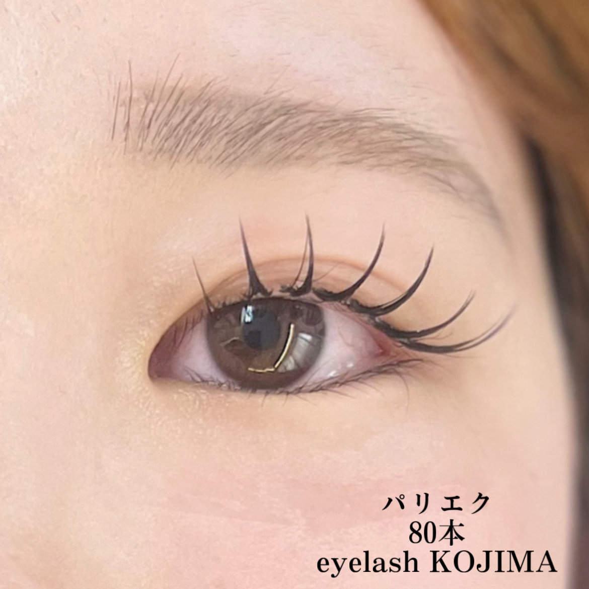 Trinity_eye