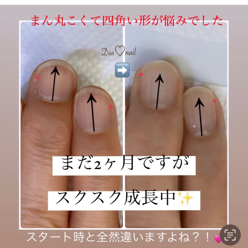 Dia..nail