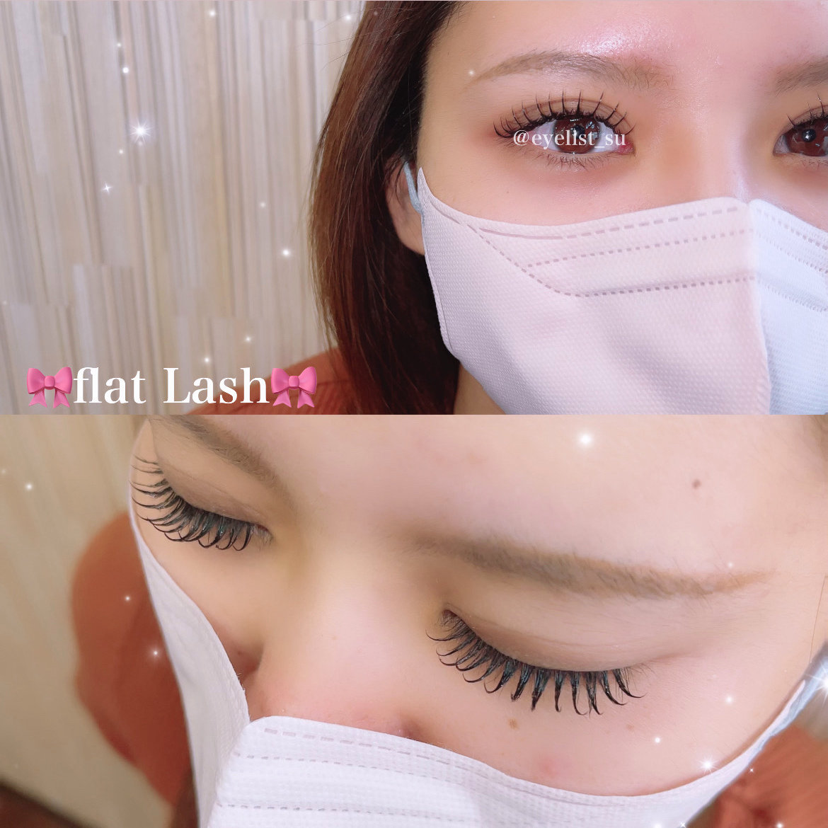 eye_su