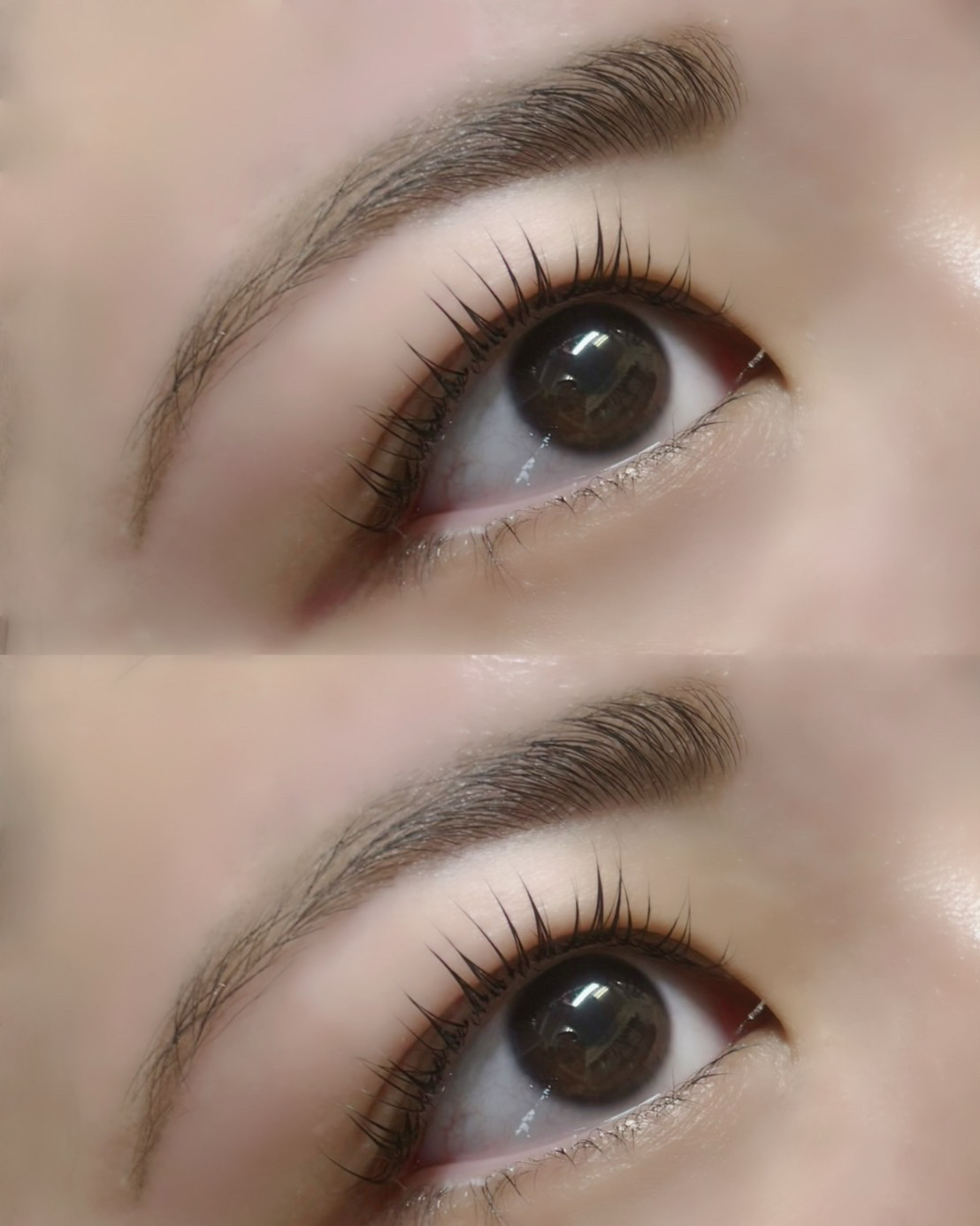 aoi__trueye
