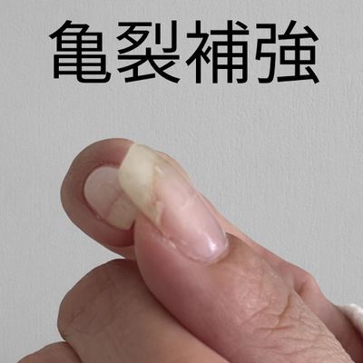 亀裂補強