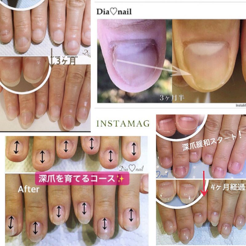 Dia♡nail