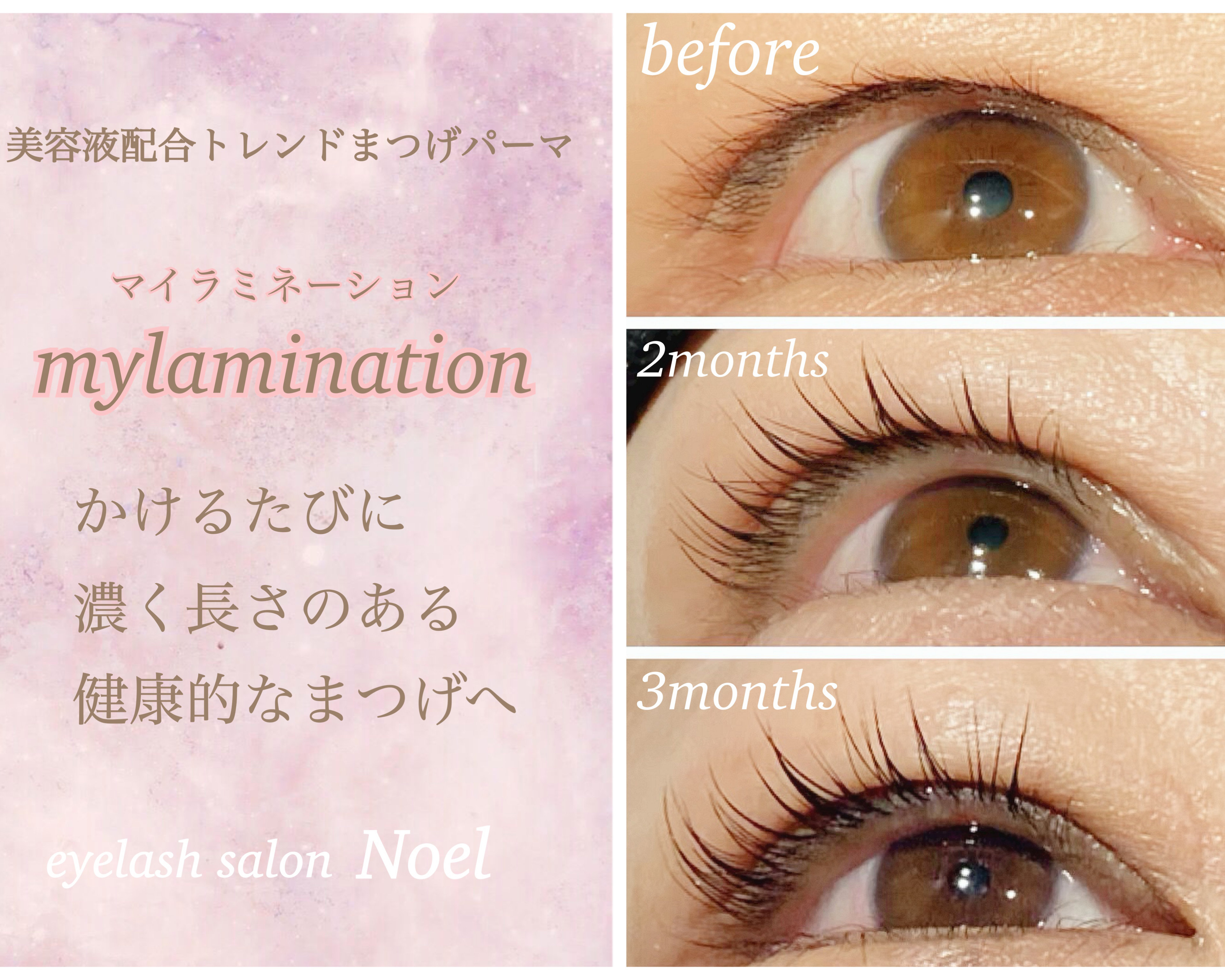noel_eyelash