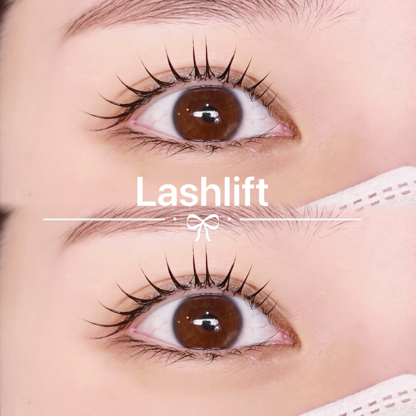 mei_trueye