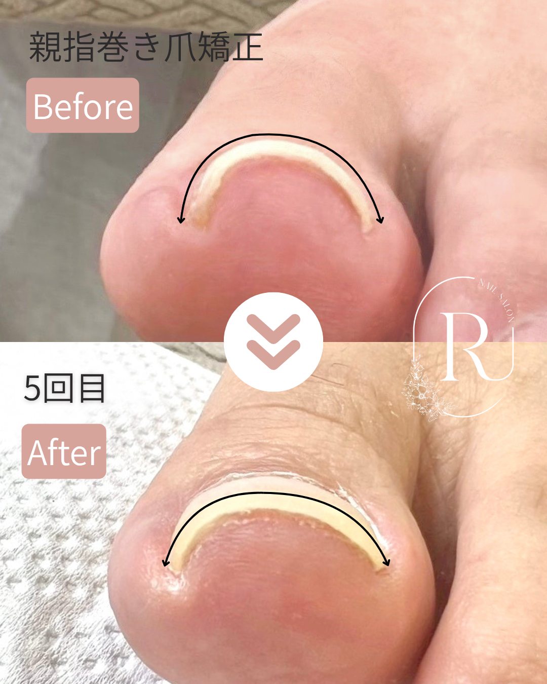 roue.nail