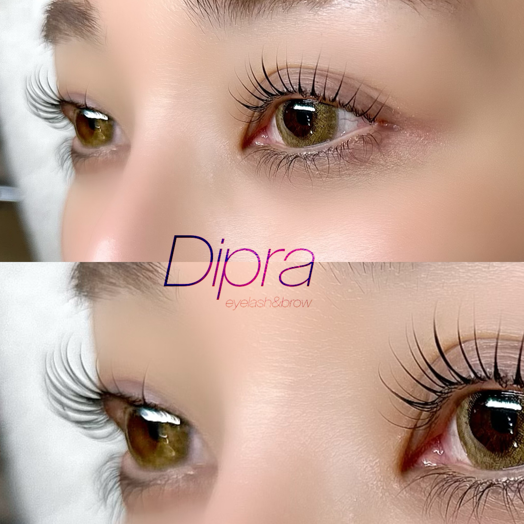 dipra.eye