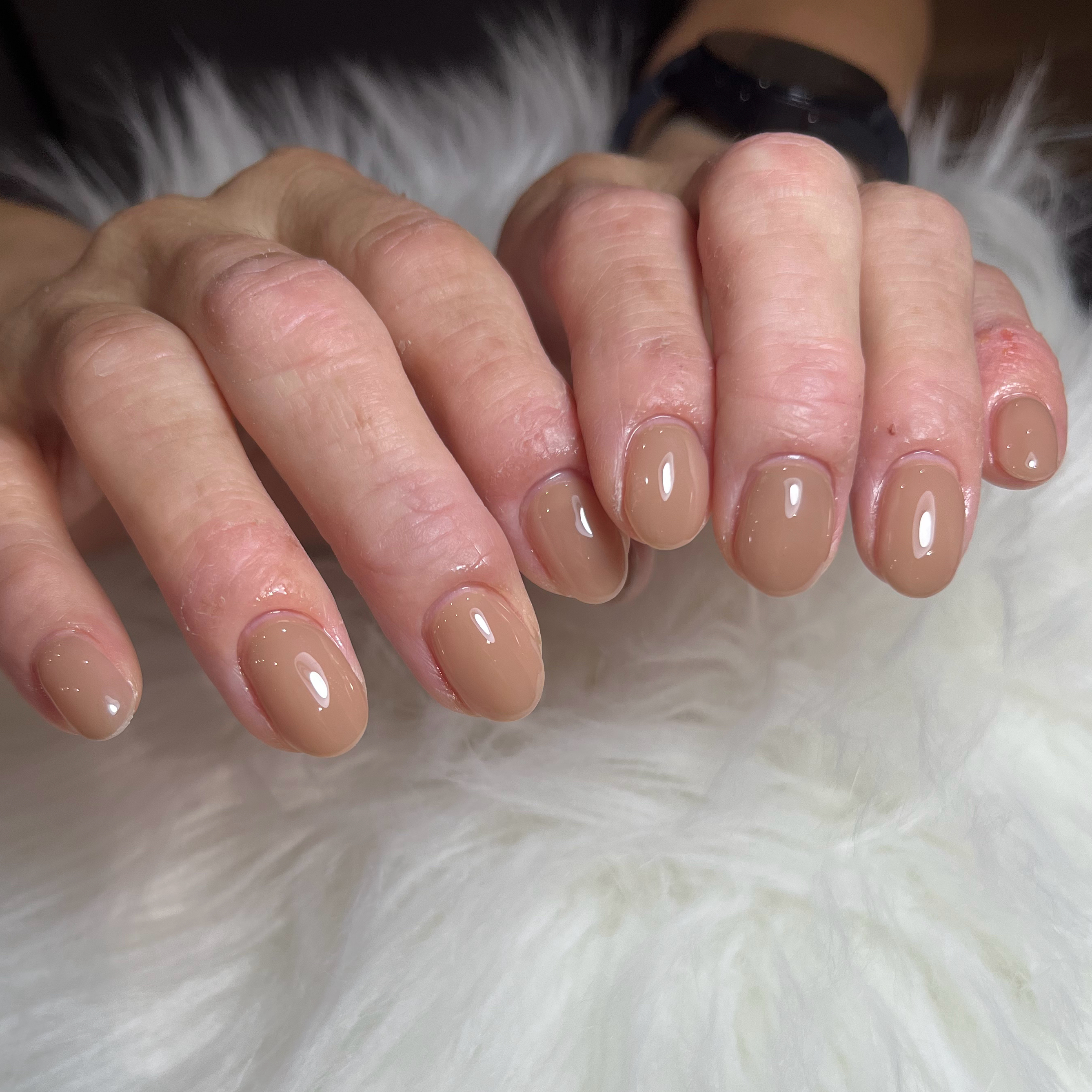 NAIL.eclat