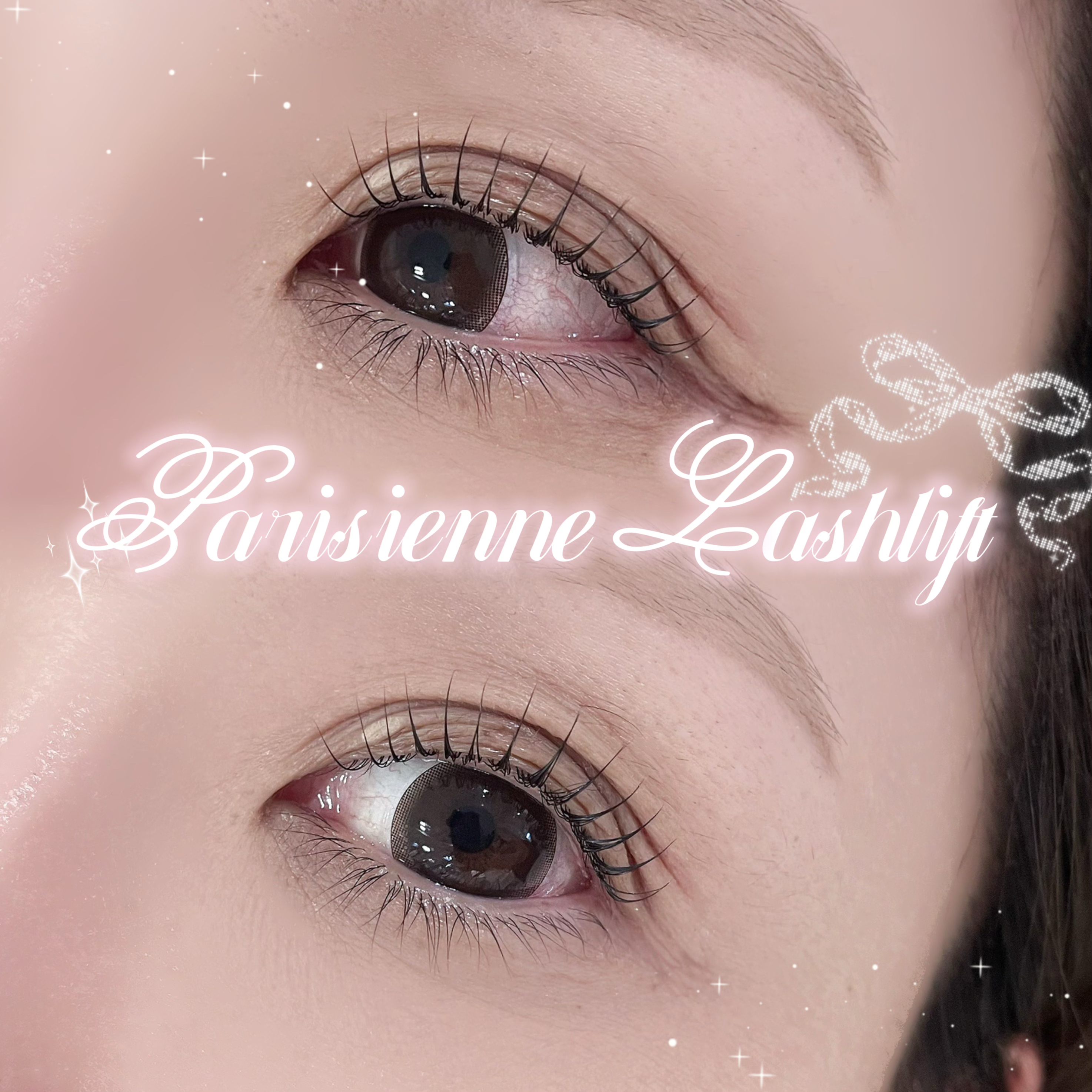 yukino_trueye