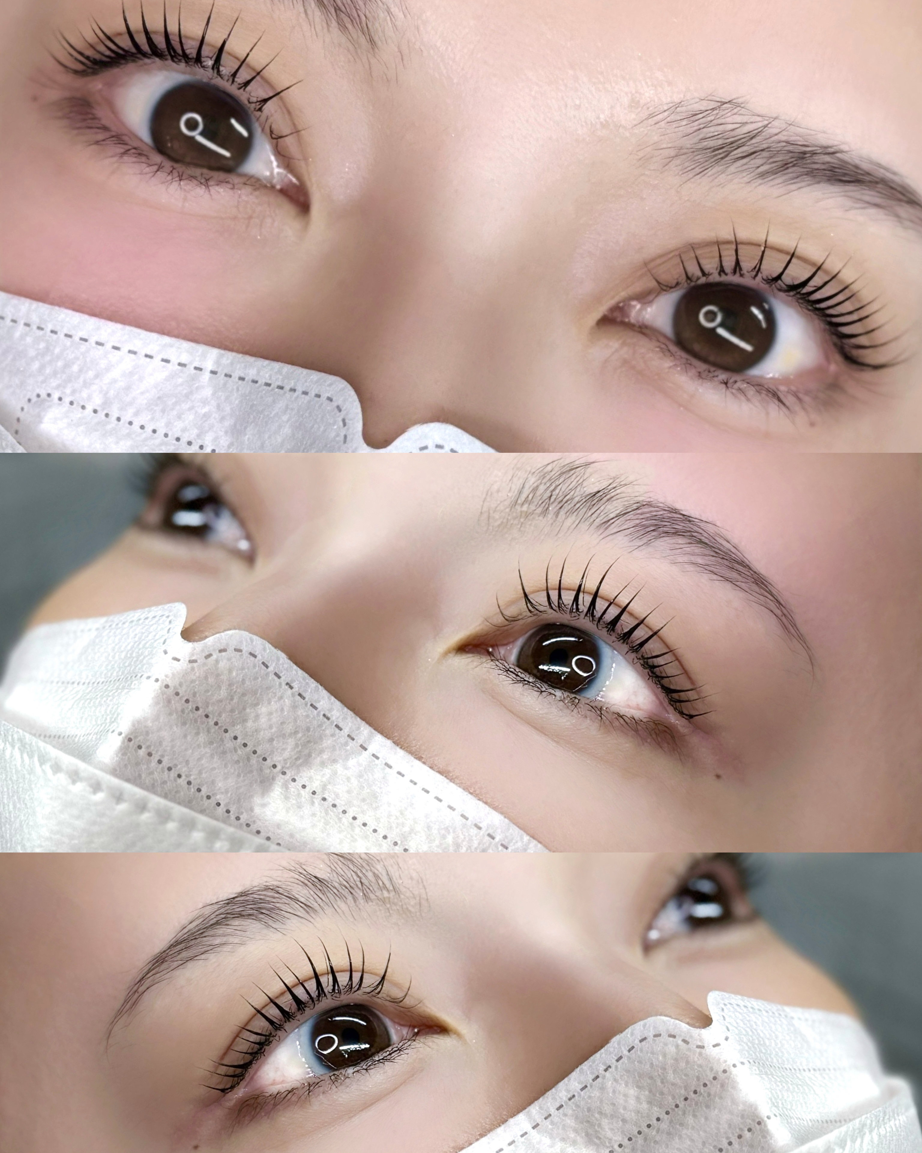 N_eye_