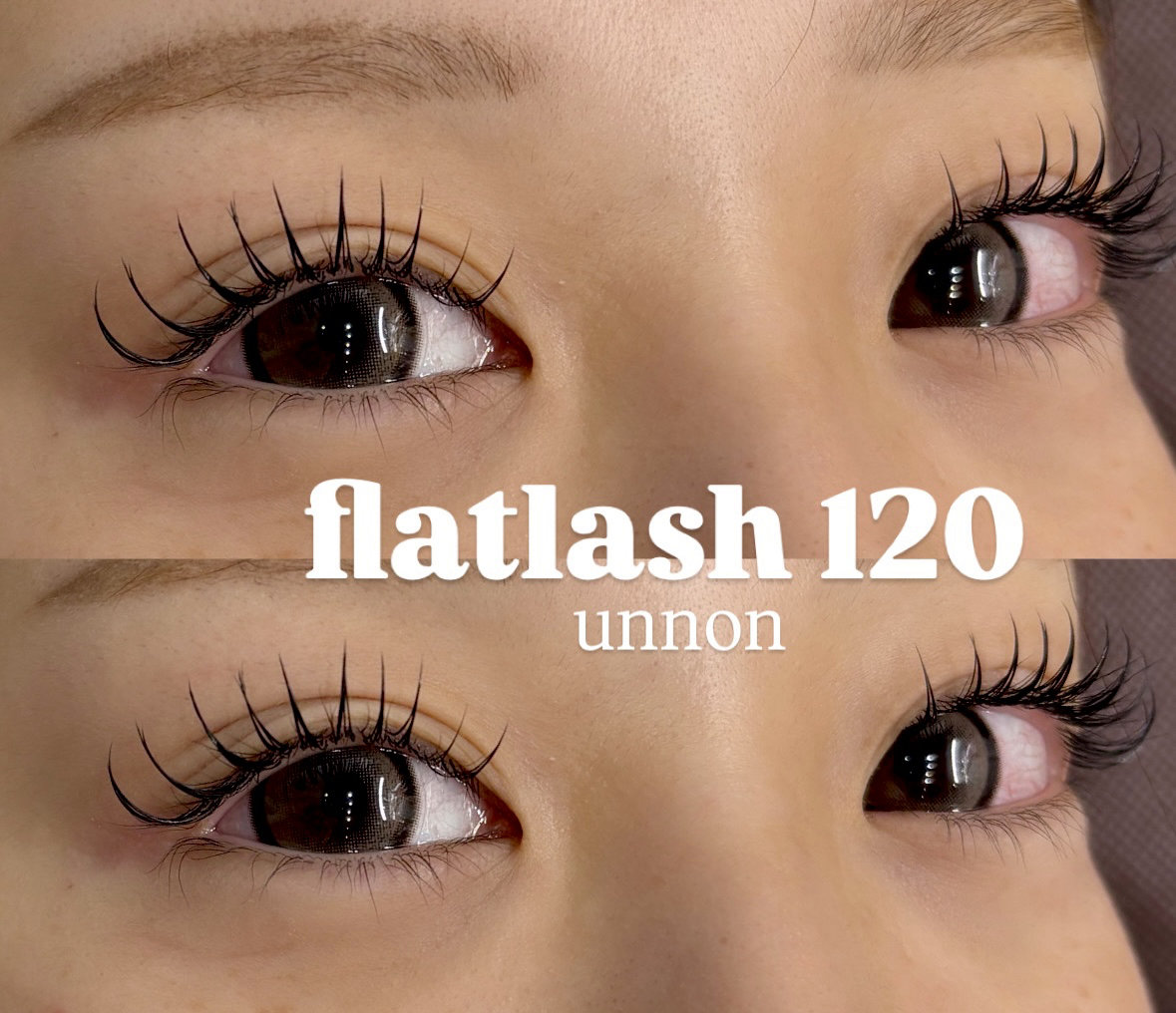 unnon_takeshita