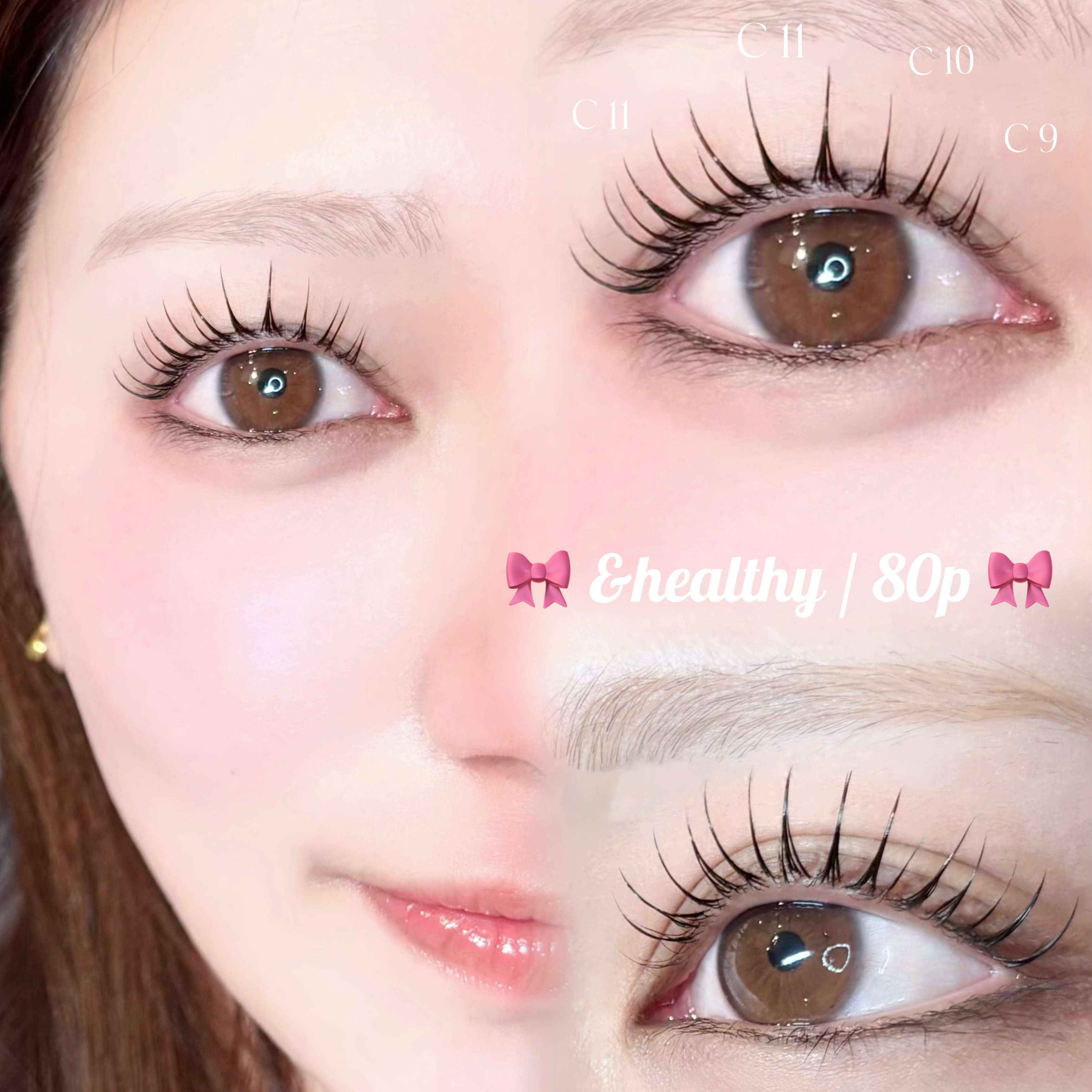 milky__eye