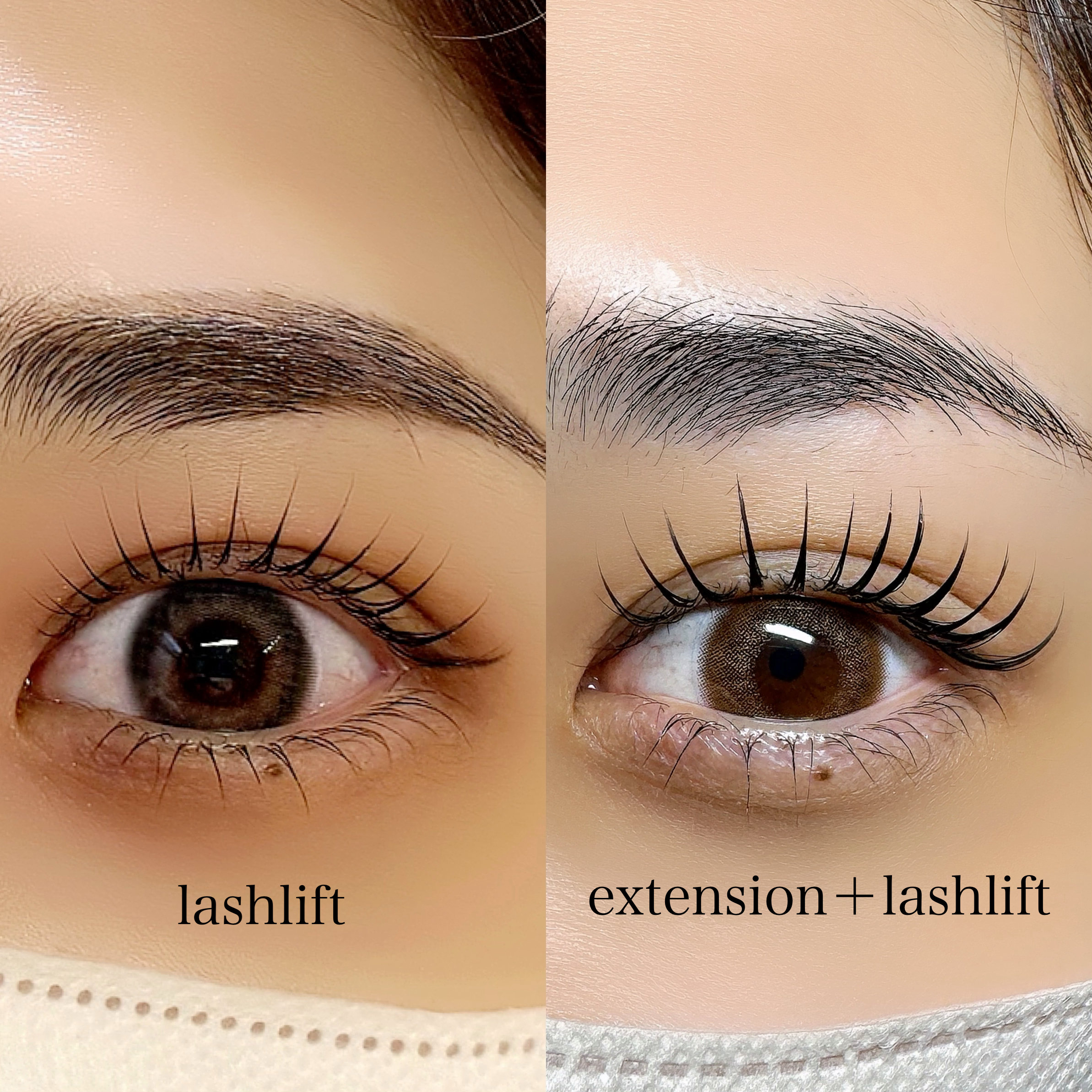 msm_eye