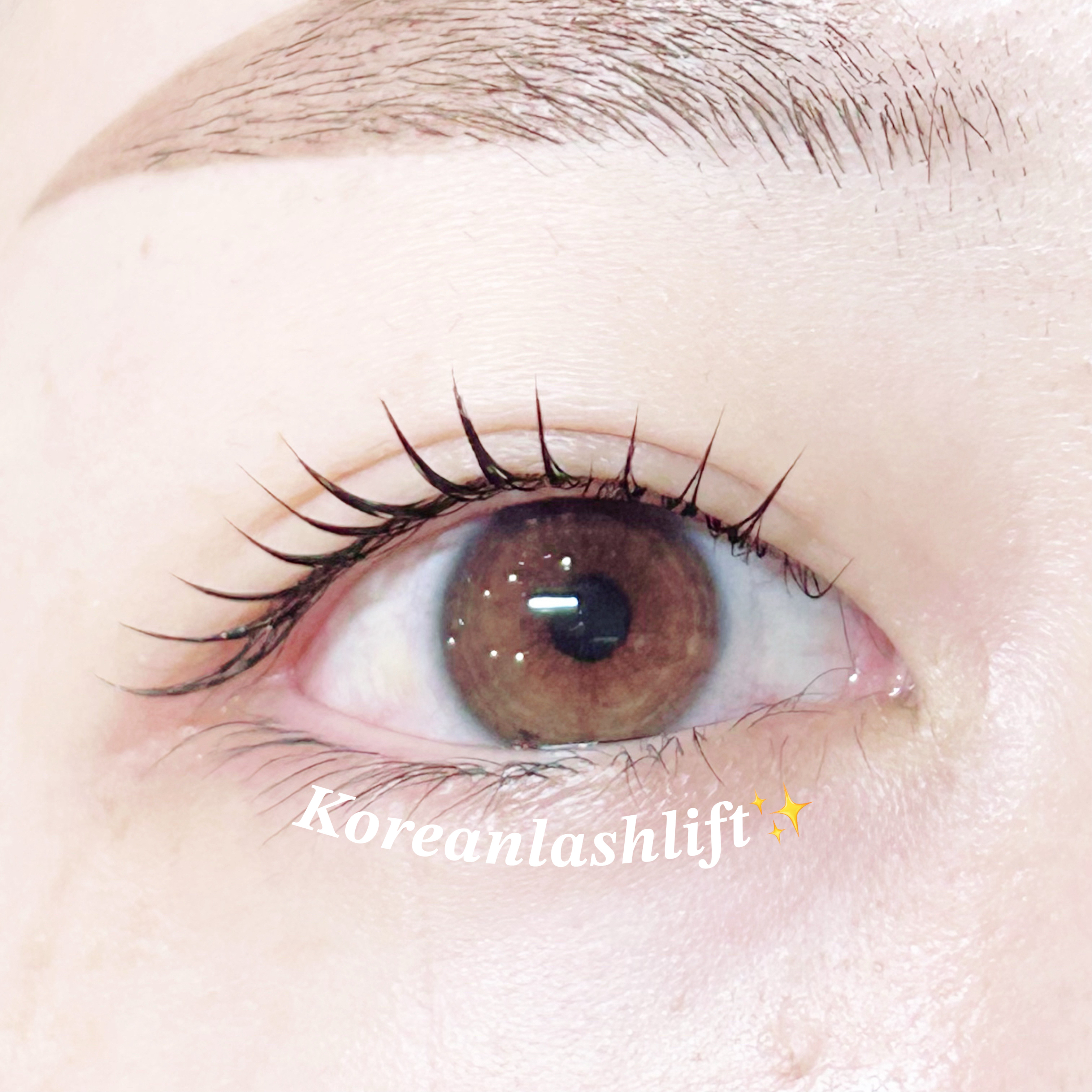 emi_trueye