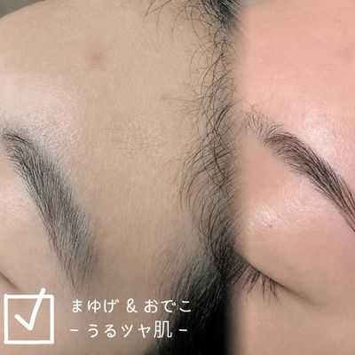 【今だけ！】眉毛wax × おでこwax