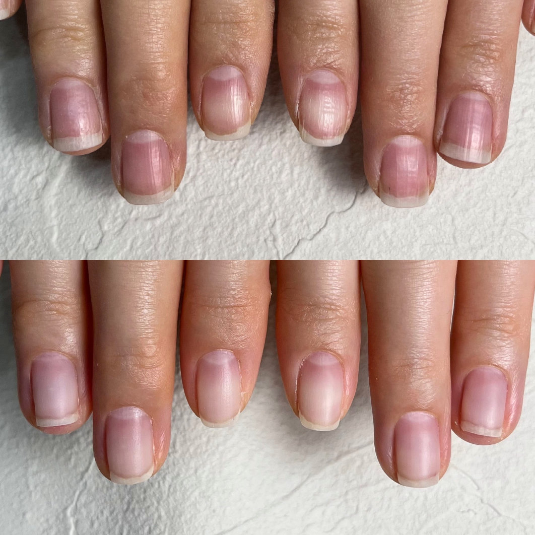 nail_izm
