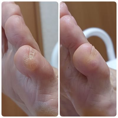 フットケアフルコース