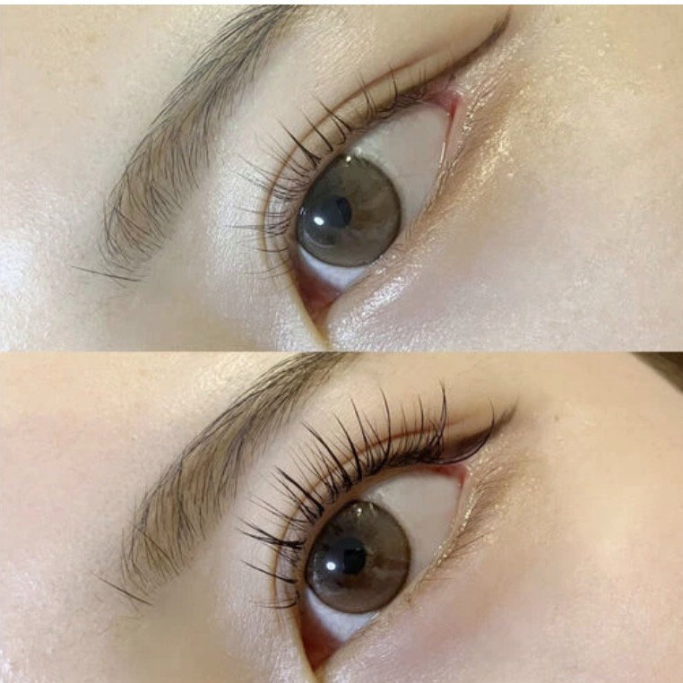 eye.list_chiyo
