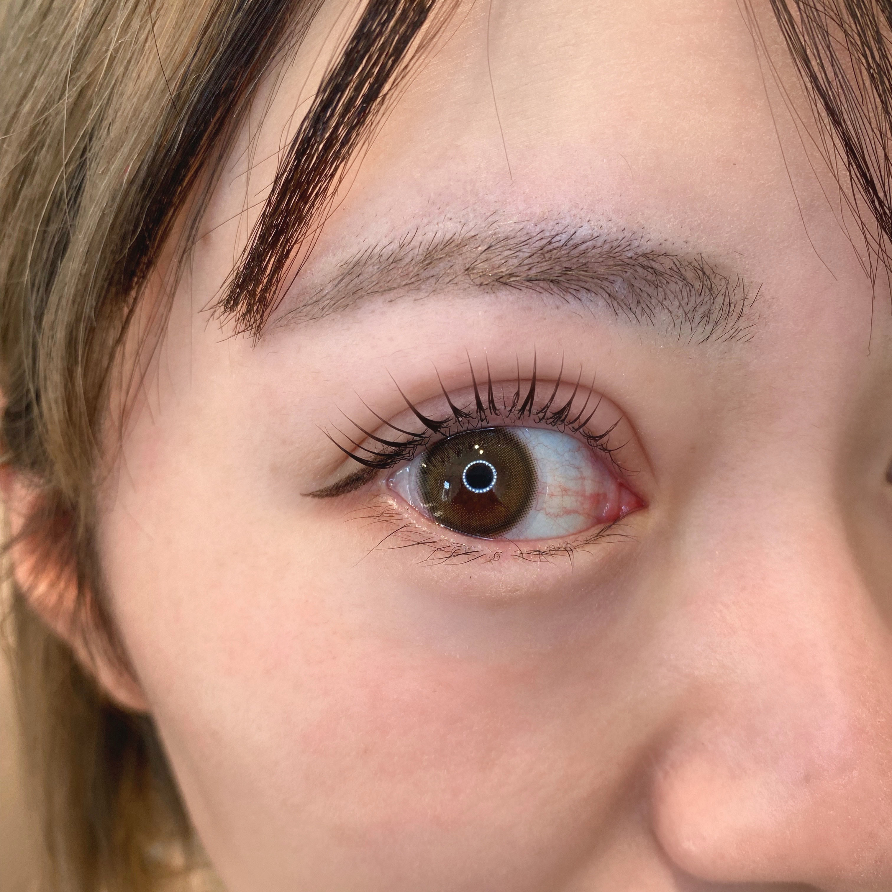 eyelist_aico
