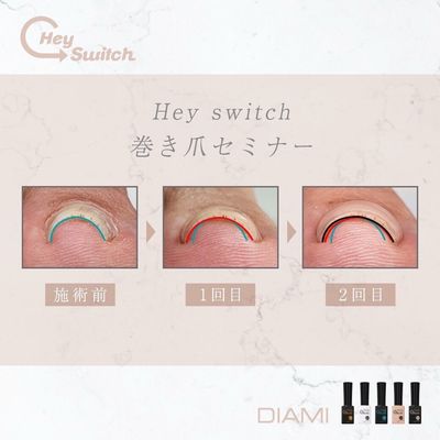 【痛い巻き爪・食い込み改善★フットバス付】特殊ジェル巻き爪ケア