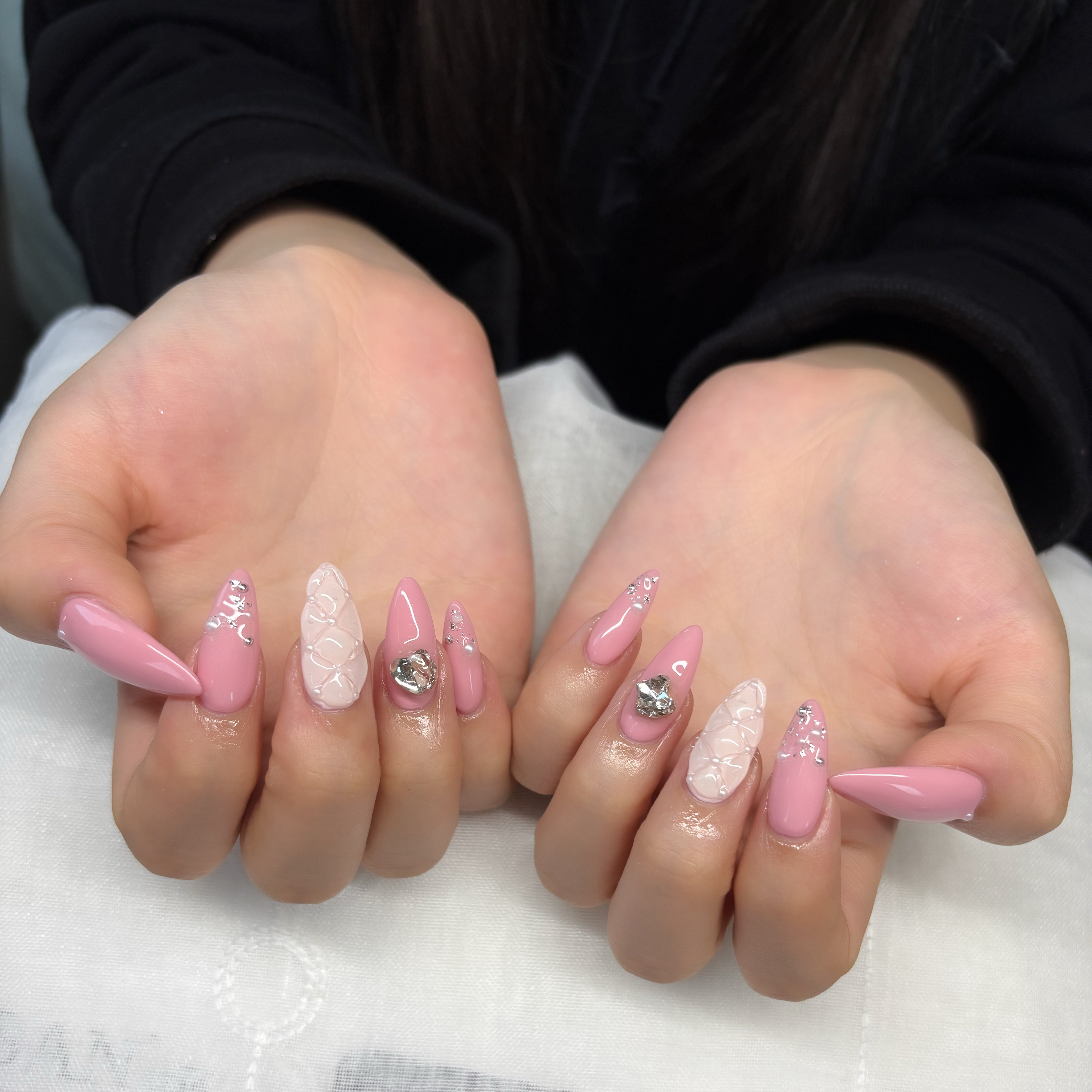 trangnail