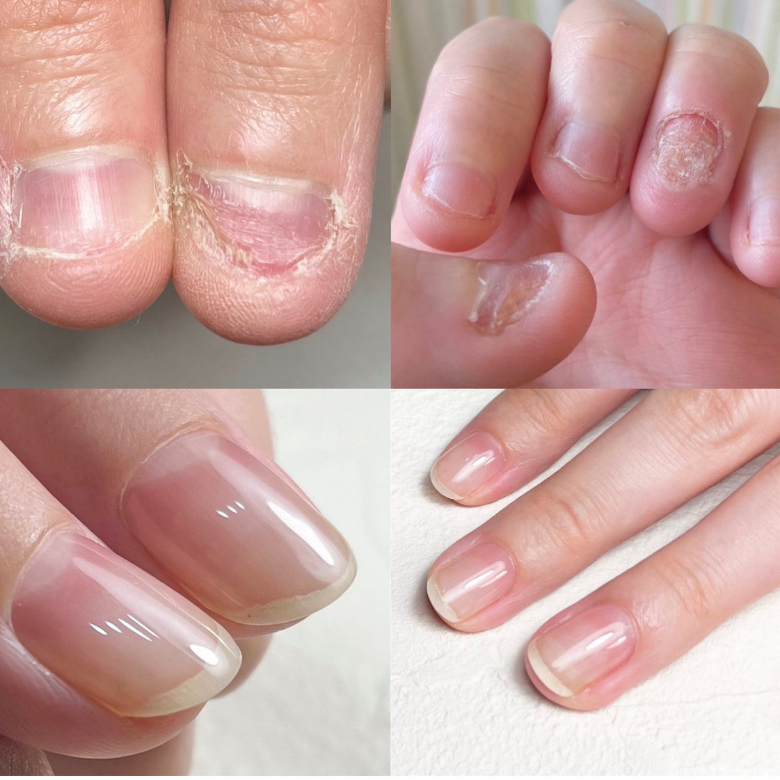 nail_izm