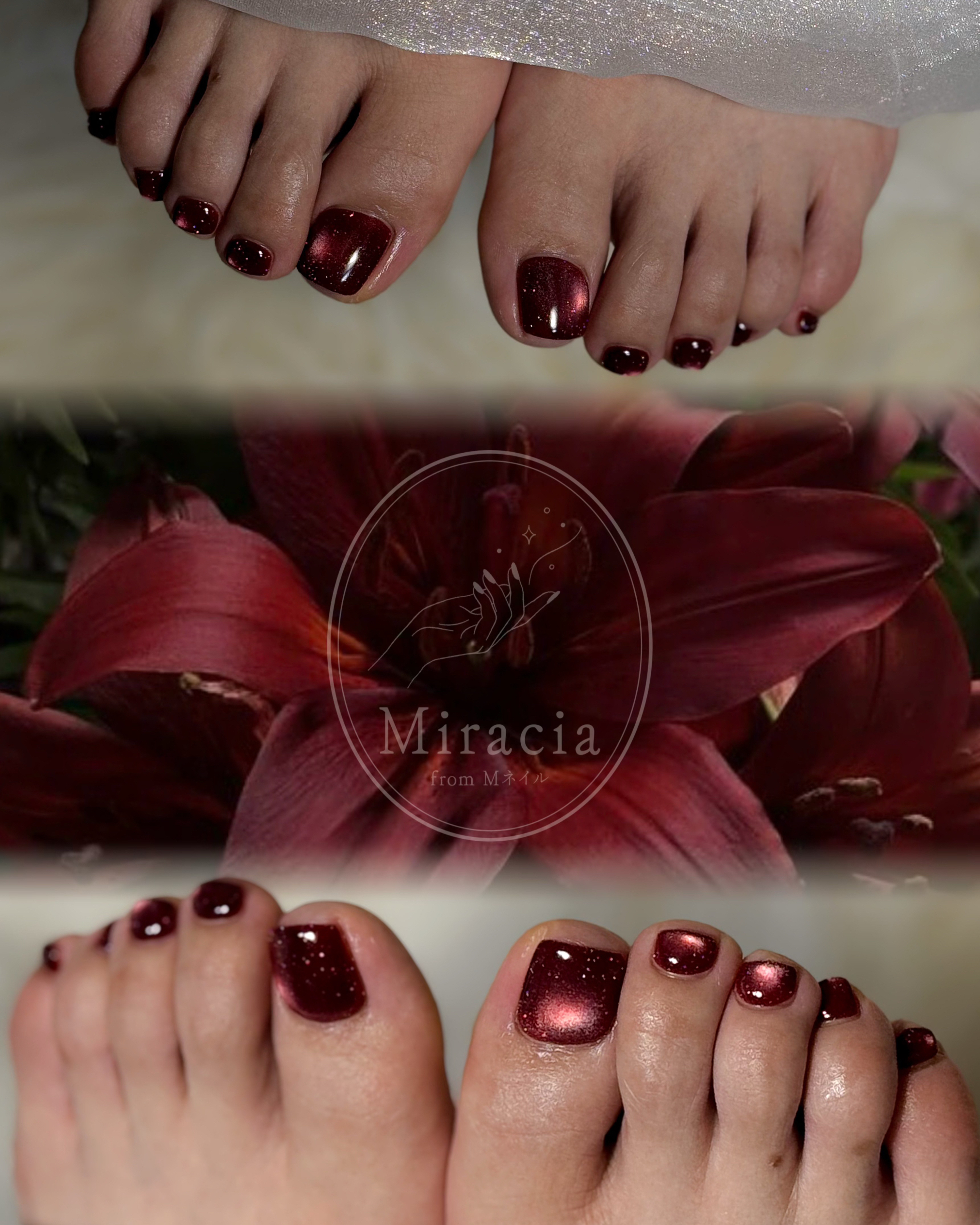 10lino.nail