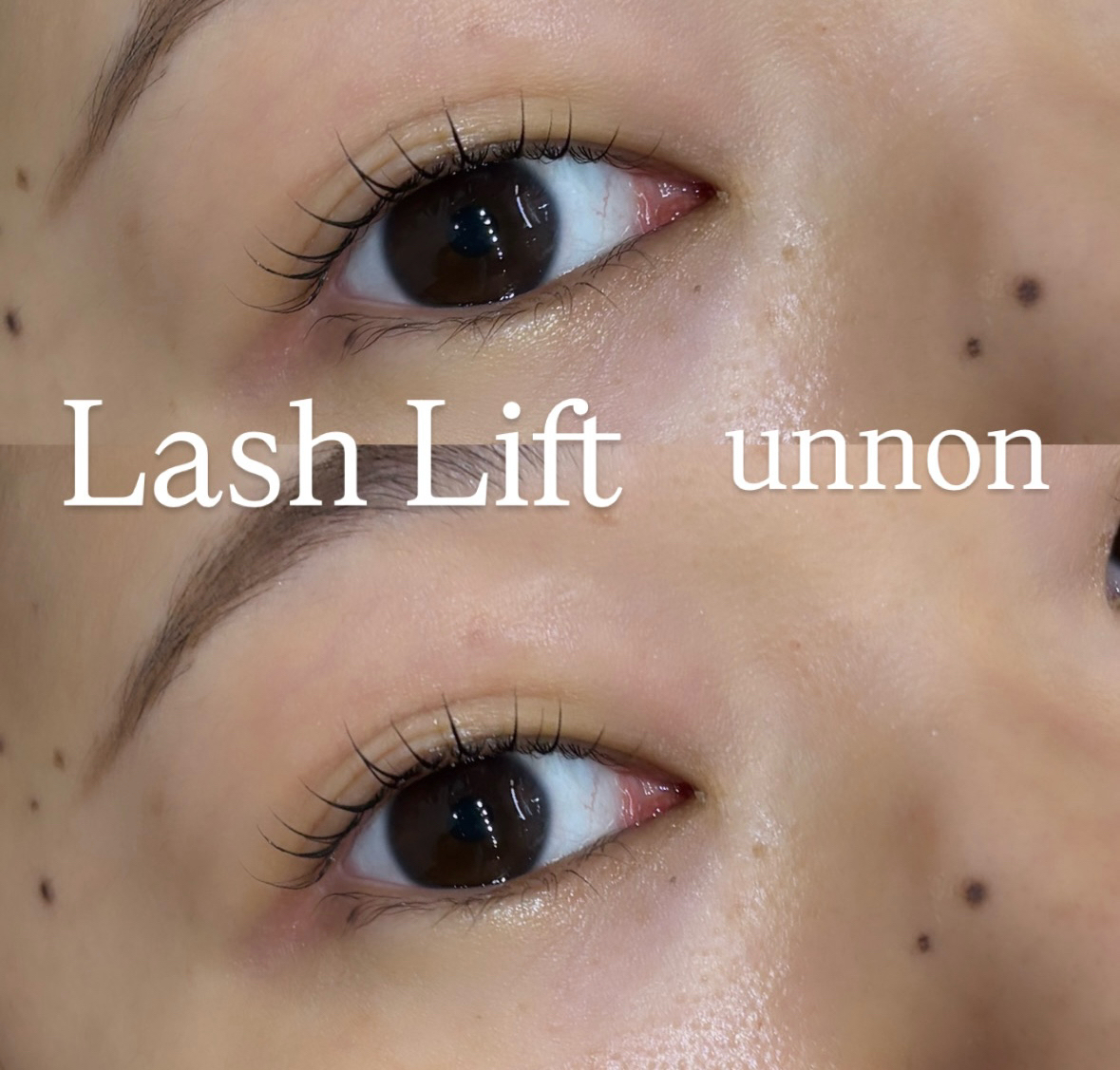 unnon_takeshita
