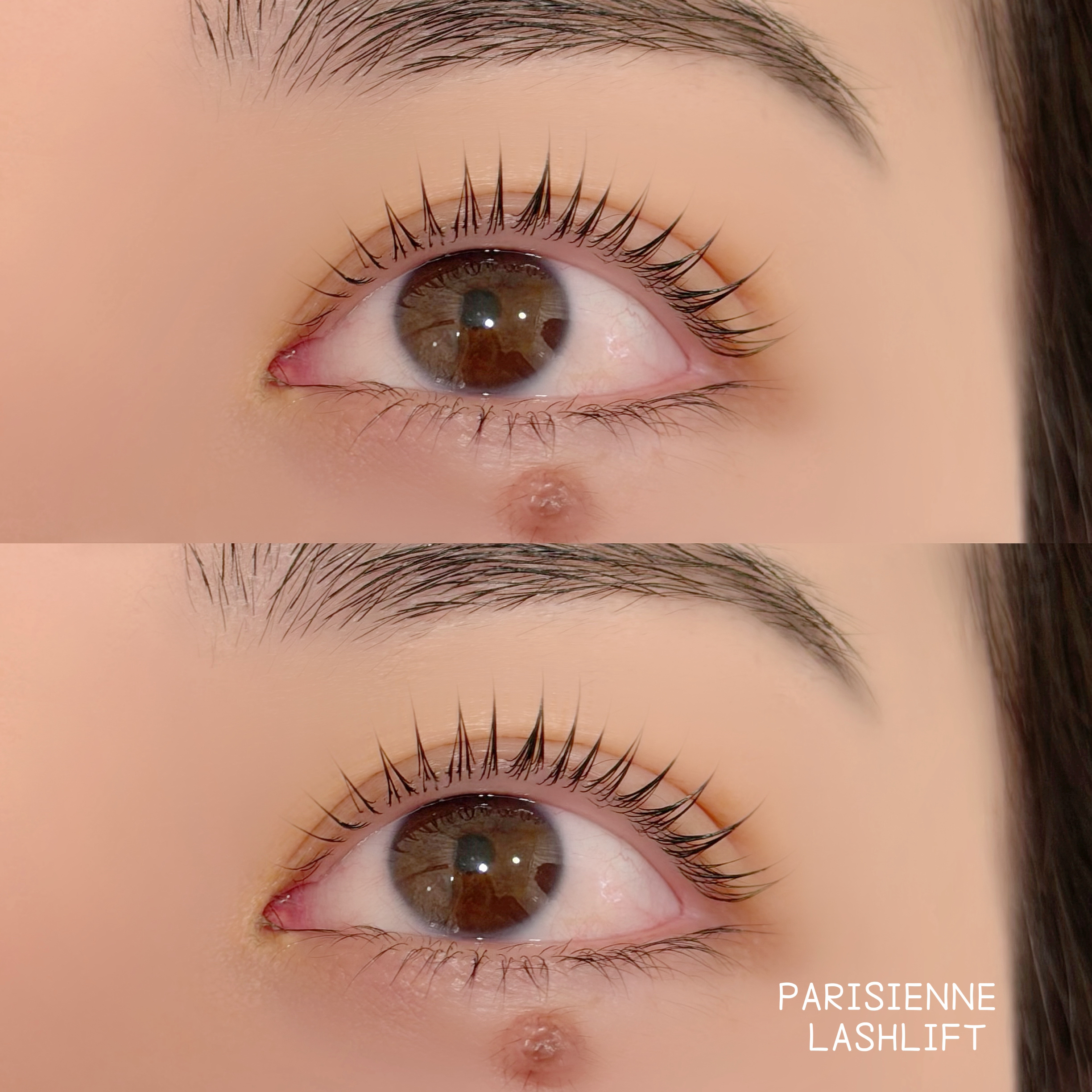 aoi_trueye