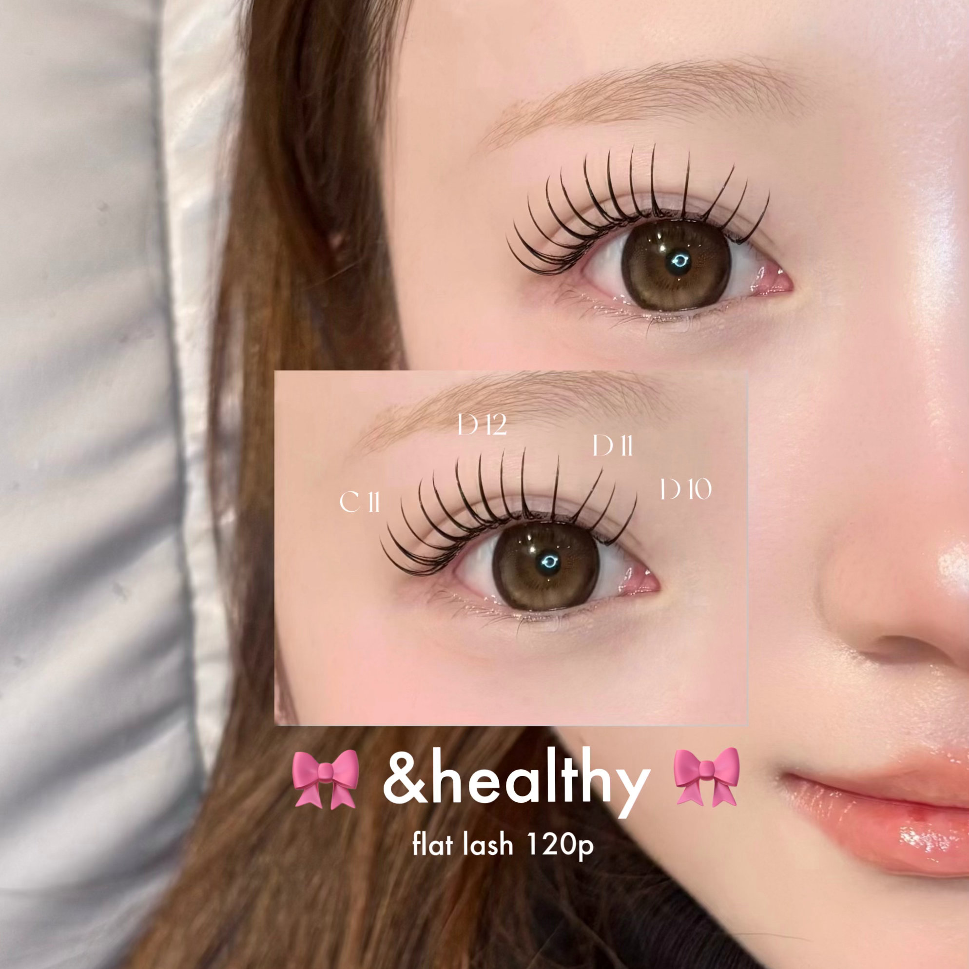 milky__eye