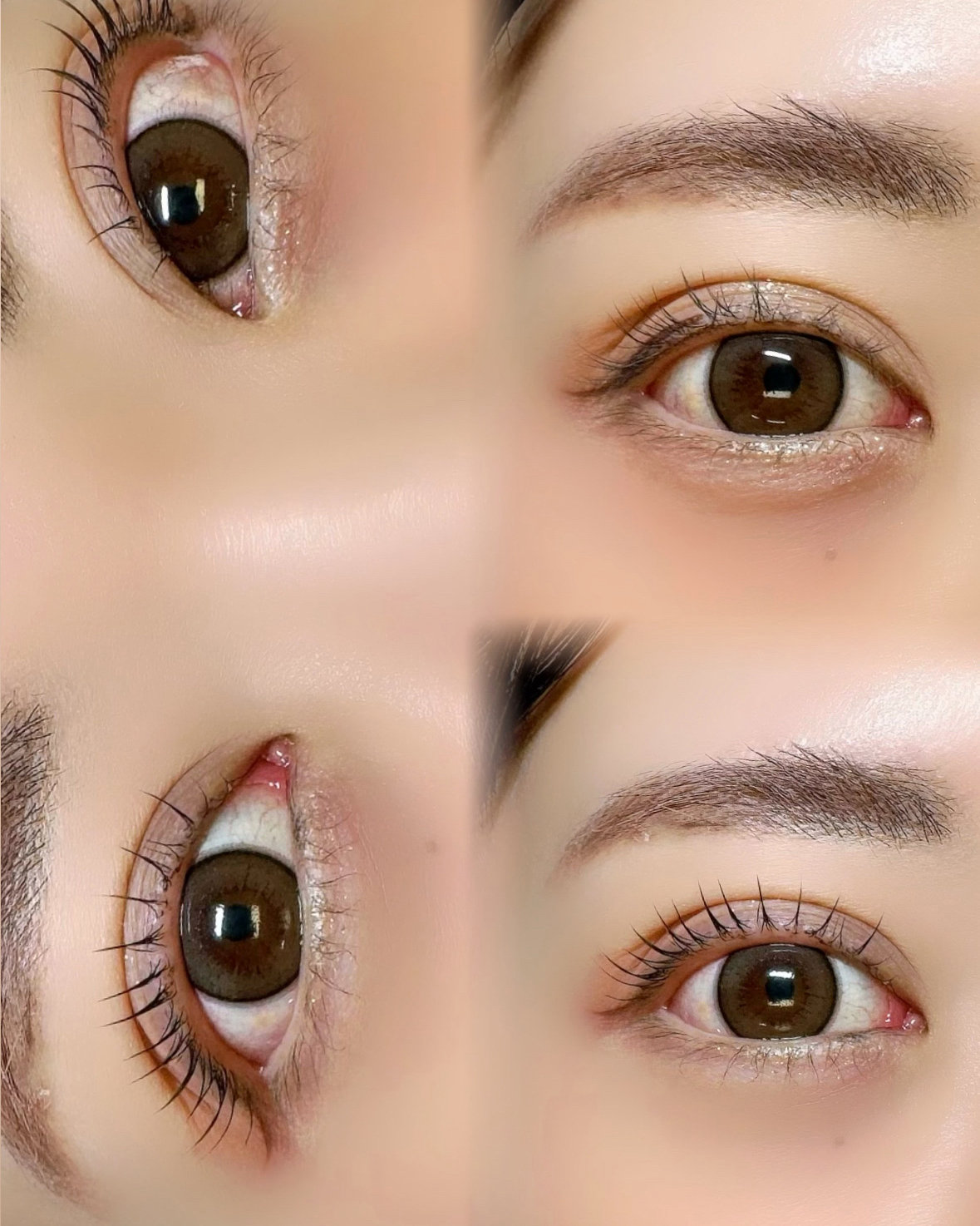 msm_eye