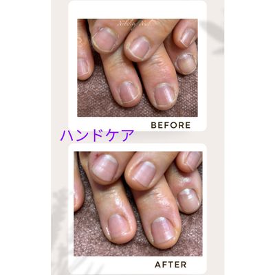 ハンドケア